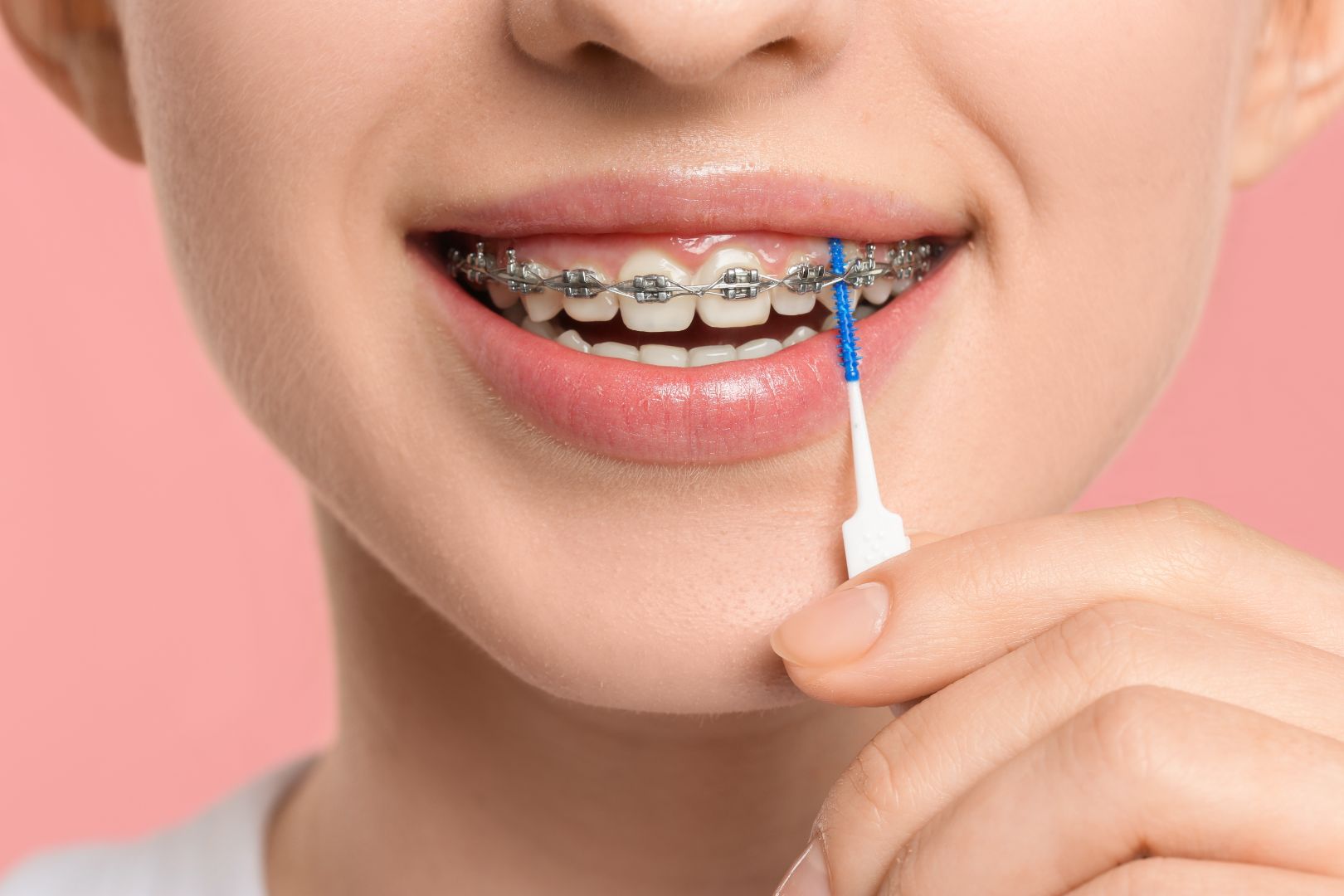 Braces-Friendly Oral Care